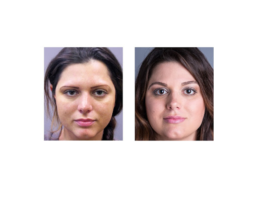 Hair Transplantation Clinic «Bosley Medical - Denver», reviews and photos, 6979 S Holly Cir #275, Centennial, CO 80112, USA