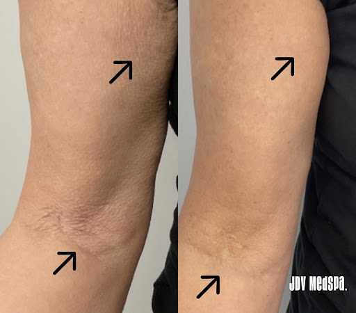 Explore cross tattoo idea, creative tattoo ideas in Canton, available at JDV Med Spa