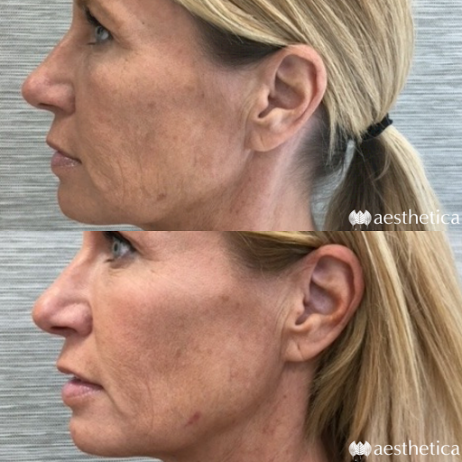 Explore bodybuilding tattoos ideas, creative tattoo ideas in Pleasant Grove, available at Aesthetica