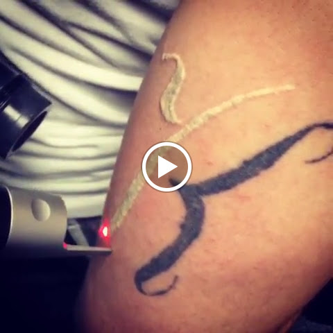 Explore hanuman tattoo ideas, creative tattoo ideas in Vienna, available at Removery Tattoo Removal & Fading