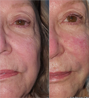 Ace Beauty Clinic - Ace Beauty Clinic