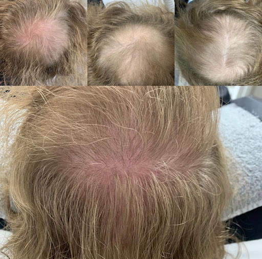 Explore genesis tattoo ideas, creative tattoo ideas in Vancouver, available at All You Aesthetics and Permanent Cosmetics