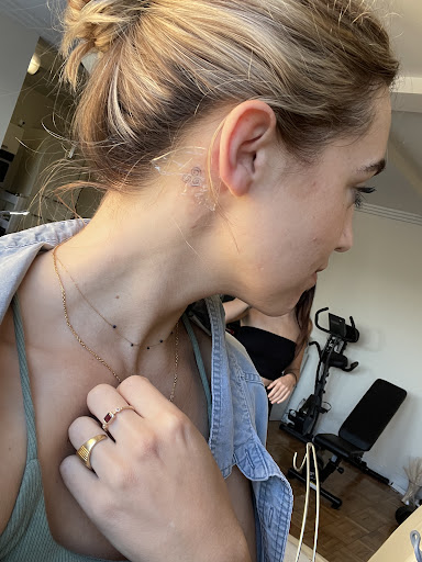 Explore shoulder scar tattoo ideas, creative tattoo ideas in Los Angeles, available at Motis Tattoos