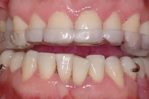 Angelucci Vazquez Odontologia Estetica Odontologo Implantes Carillas Ortodoncista en Nuñez Capital Federal image