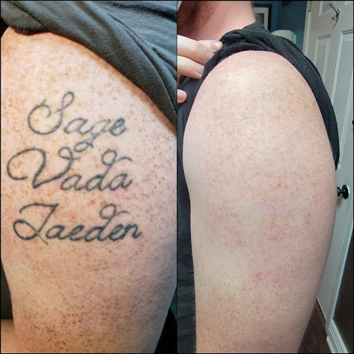 Explore 111 angel number tattoo ideas, creative tattoo ideas in Dubuque, available at Retrospect Tattoo Removal
