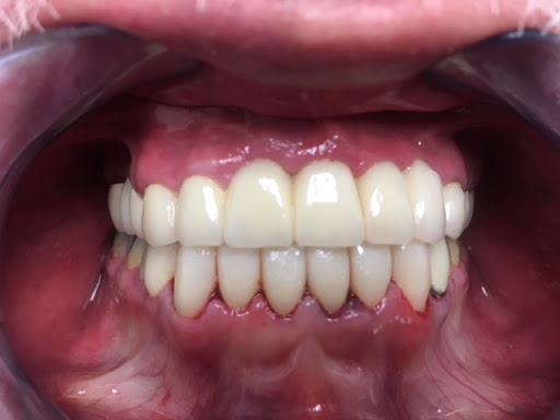 Dental implants periodontist Norwalk