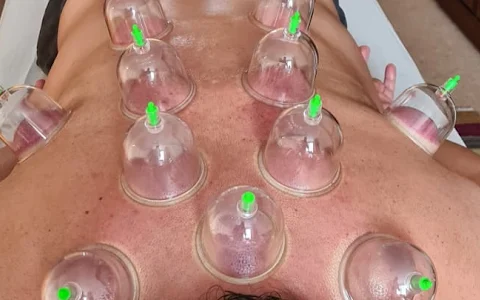 Nur Therapy Cupping Centre image