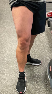 Avicenna Acupuncture & Lymphedema Clinic - Photo 5 - Car repair in Wheat Ridge, CO, Lakewood