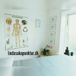 Lindas Akupunktur