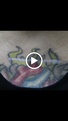 Explore skull hand tattoo ideas, creative tattoo ideas in New York, available at Ag2g Laser Tattoo Removal & MedSpa