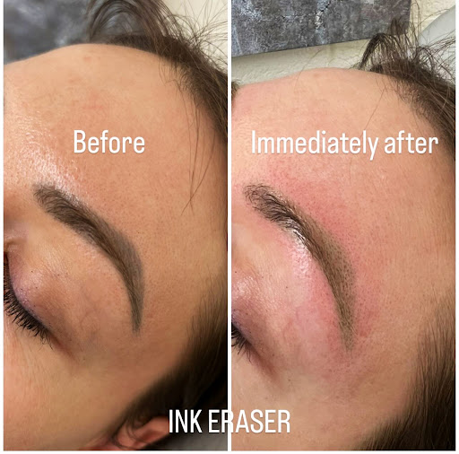 Find buck tattoo ideas for your next unique tattoo in Scottsdale at The INK Eraser