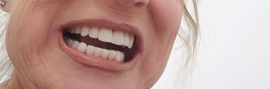 الدكتور Jesus في مجموعة Valenzuela لطب الأسنان - Dr Jesus at Valenzuela Dental Group