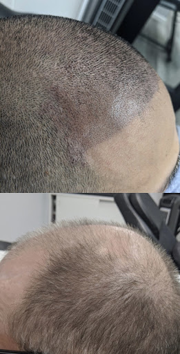 Find tattoo gift ideas for your next unique tattoo in Roseville at NuHair Ink. Scalp MicroPigmentation & Aesthetic Clinic of Sacramento