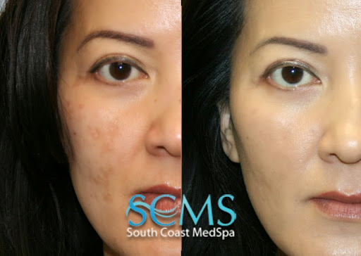 South Coast MedSpa image