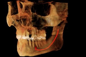 RadioLogic 3D Radiografías Panorámicas y Tomografías Dentales image