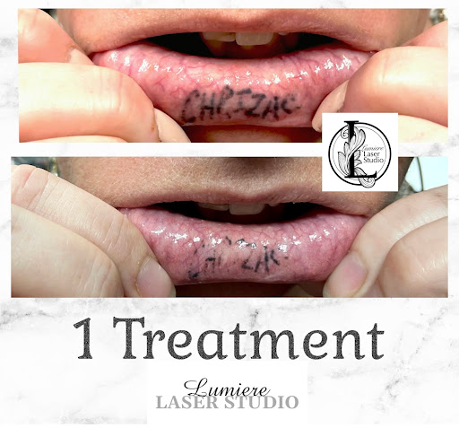 Explore small plant tattoo ideas, creative tattoo ideas in Ballwin, available at Lumiere Laser Studio