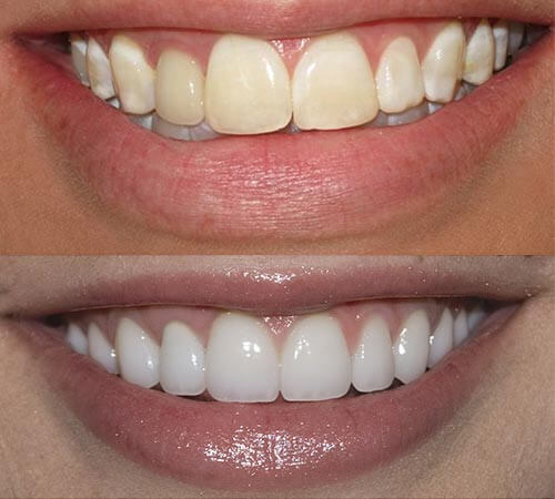 Teeth & More