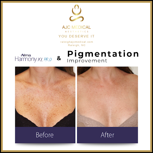 Find tattoo armband ideas for your next unique tattoo in Raleigh at AJC Medical Aesthetics