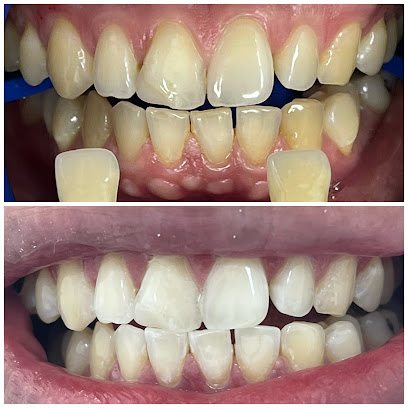 Bangkaew Smile Dental Clinic คลินิคทันตกรรมบางเเก้วสไมล์ รับจัดฟัน ทำรากเทียม ครอบฟัน