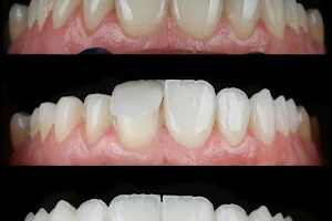 Radial Dente image