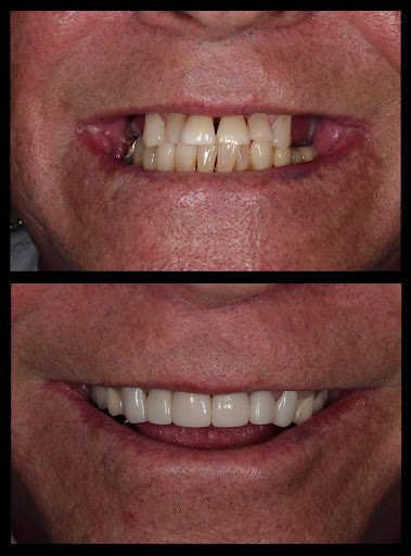 SDDS Dental - Implant, Veneer, Invisalign, and General Dentist