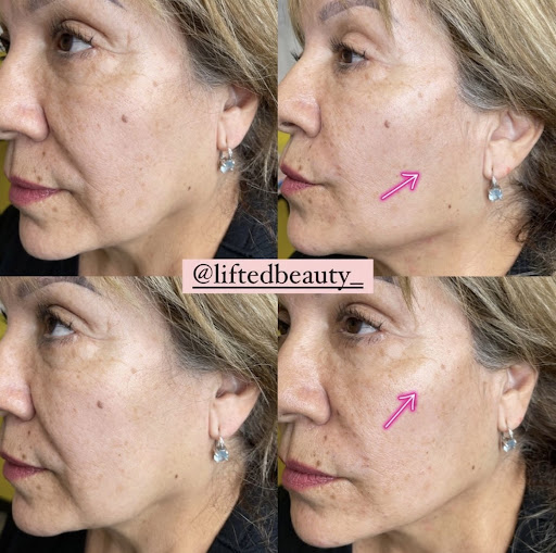 Lifted Beauty Medical Practice image