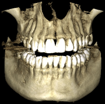 Rx Digital, Radiografías Odontológicas Digitales