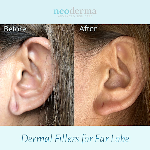 Explore grandkid tattoo ideas, creative tattoo ideas in Anaheim, available at Neoderma