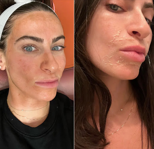 Explore fallen soldier tattoo ideas, creative tattoo ideas in Latrobe, available at Laser180