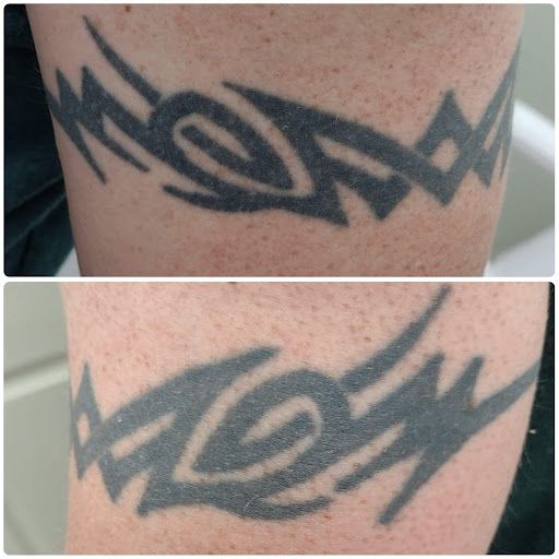 Explore fisherman tattoo ideas, creative tattoo ideas in Brighton, available at Tip of the Spear Laser Esthetics