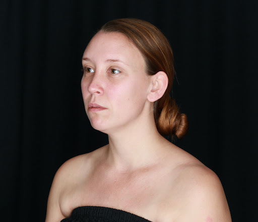 Burbank Plastic Surgery image