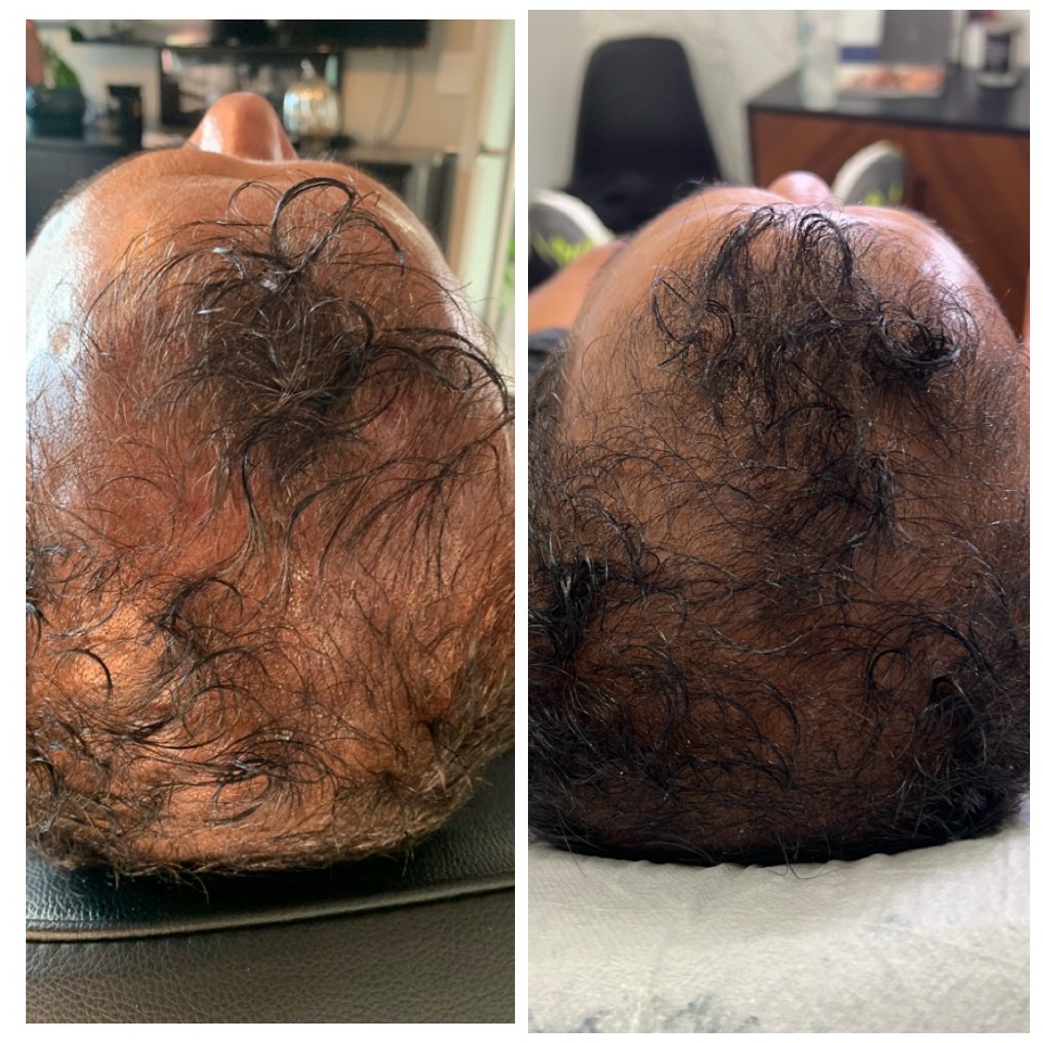 Frisch Aesthetics at Naked Sun 60416