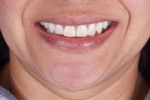 Clínica Dental kököa image