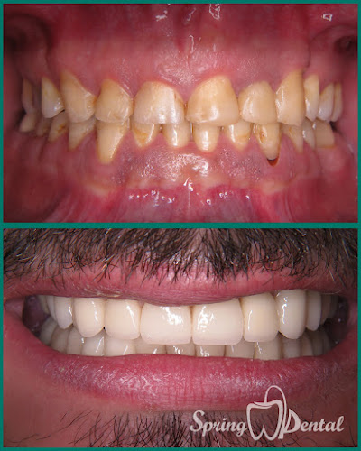 Comentarii opinii despre Spring Dental - Stomatologie Sector 4