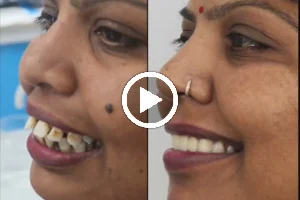 YouDent Hospital - Best Dental Clinic in Jaipur & Dentist in Jaipur, Dental Implant, Braces, Root Canal, Smile Designing image