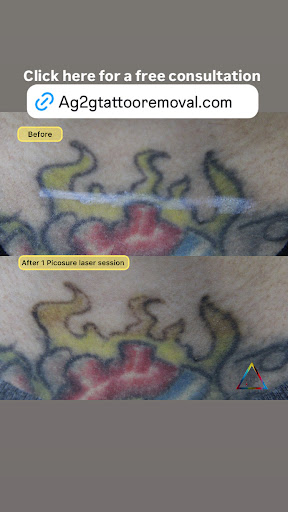 Explore fenrir tattoo ideas, creative tattoo ideas in New York, available at Ag2g Laser Tattoo Removal & MedSpa