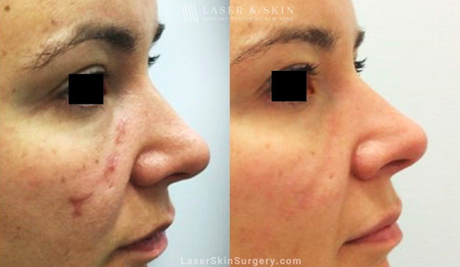 Explore small zelda tattoo ideas, creative tattoo ideas in New York, available at Laser & Skin Surgery Center