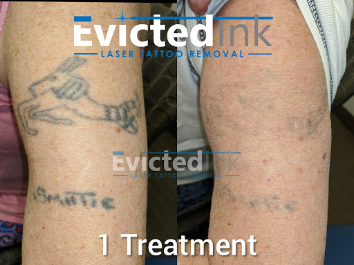 Explore cover up tattoo ideas on ankle, creative tattoo ideas in Wichita, available at Evicted Ink Laser Tattoo Removal