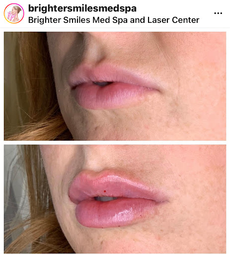 Explore da vinci tattoo ideas, creative tattoo ideas in Eugene, available at Brighter Smiles Med Spa and Laser Center