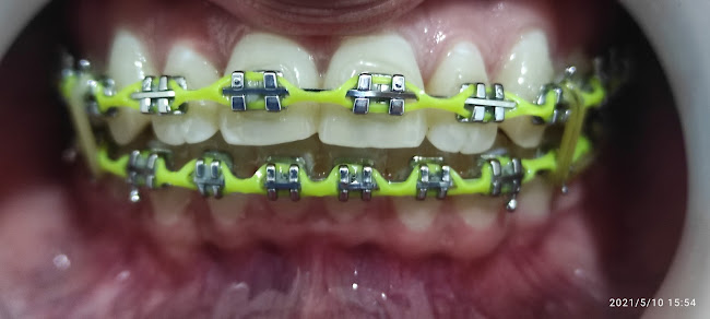 Clínica de Ortodoncia y Estética Dental MaNie Dental - Rocafuerte