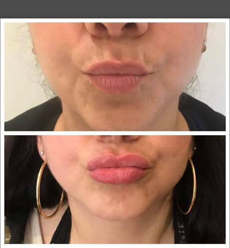 Find gay tattoo ideas for guys for your next unique tattoo in Summit at Ethos Aesthetics and Wellness, Laser Hair Removal and Med Spa