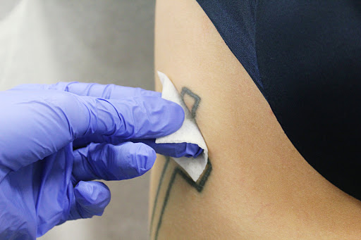 Explore iroh tattoo ideas, creative tattoo ideas in Amarillo, available at Progress MD Tattoo Removal