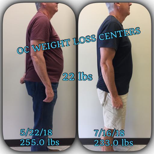 OC Weight Loss Centers & CoolSculpting image