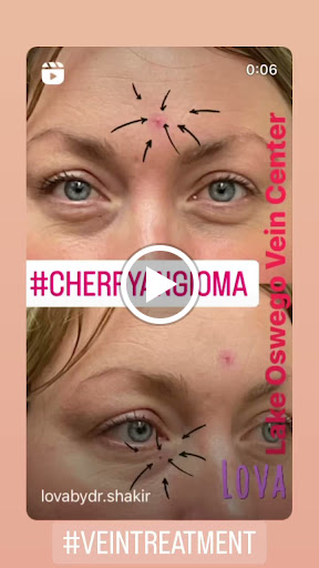 Explore cute heart tattoo ideas, creative tattoo ideas in Lake Oswego, available at Lake Oswego Vein and Aesthetic LOVA