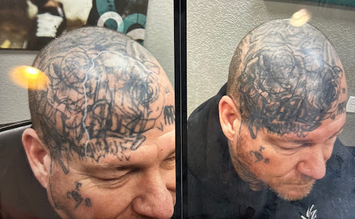 Explore tattoo ideas mushroom, creative tattoo ideas in Lancaster, available at Removery Tattoo Removal & Fading