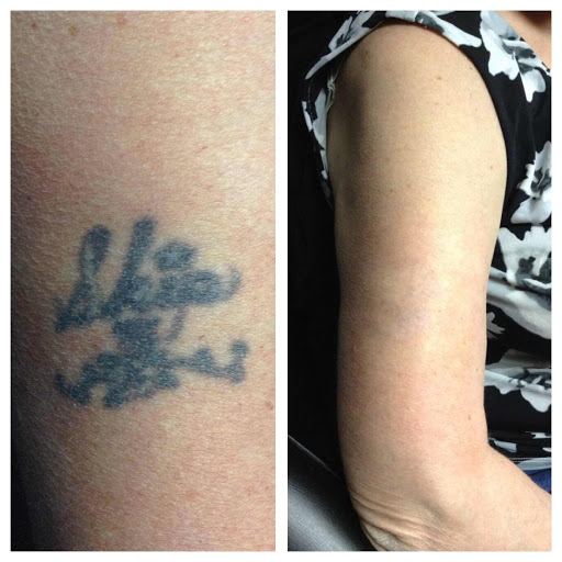 Find cool dog tattoo ideas for your next unique tattoo in Lawrence at Removery Tattoo Removal & Fading