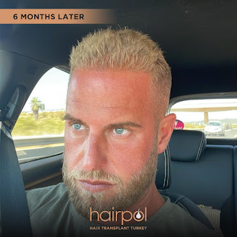 Hairpol Hair Clinic - Hairpol Hair Clinic