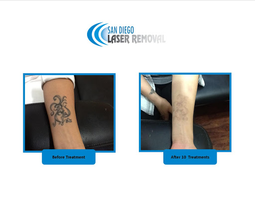 Explore medusa tattoo ideas female, creative tattoo ideas in San Diego, available at Removery Tattoo Removal & Fading