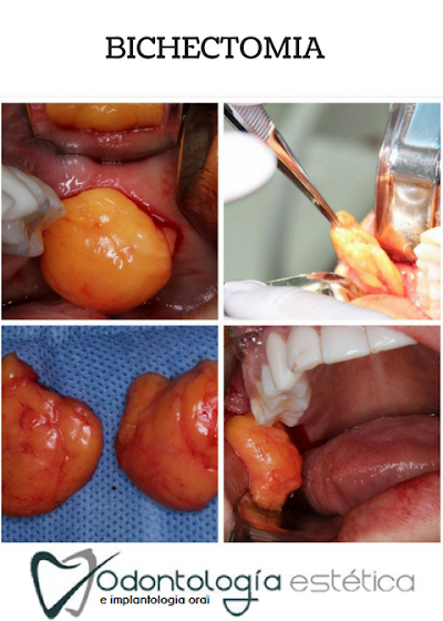 Photos of Odontolog&iacute;a Estetica e Implantologia Oral