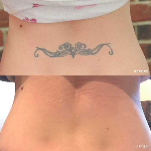 Explore tattoo ideas ribs, creative tattoo ideas in Glen Mills, available at Removery Tattoo Removal & Fading